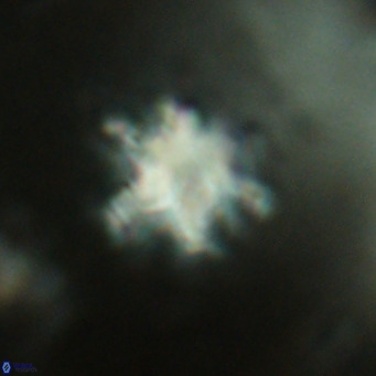 Discoaster catillomicros VR 17996