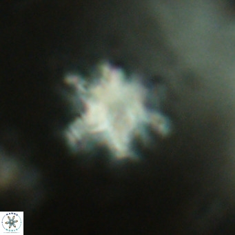 Discoaster catillomicros VR 17996