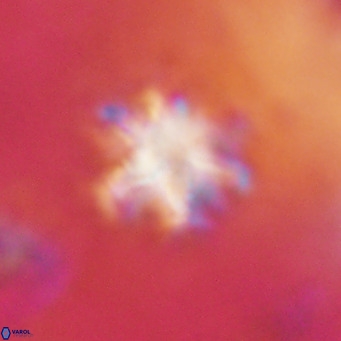 Discoaster catillomicros VR 17997