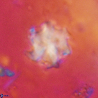 Discoaster catillomicros VR 17998