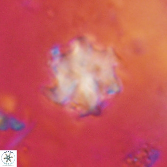 Discoaster catillomicros VR 17998