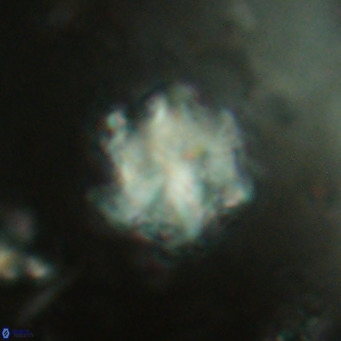 Discoaster catillomicros VR 17999