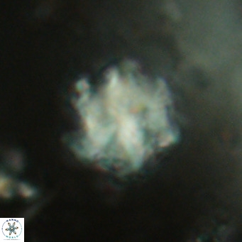 Discoaster catillomicros VR 17999