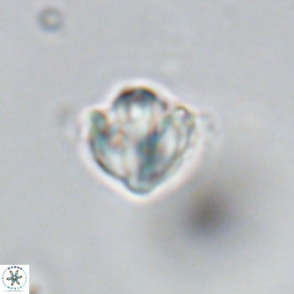 Discoaster catillomicros VR 18646
