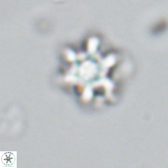 Discoaster catillomicros VR 18649