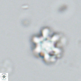 Discoaster catillomicros VR 18650