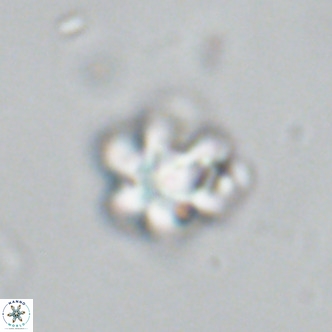Discoaster catillomicros VR 18651