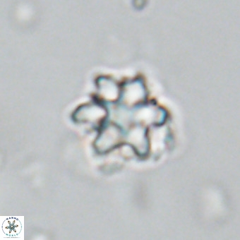 Discoaster catillomicros VR 18653