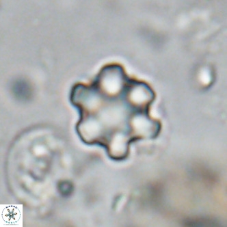 Discoaster catillomicros VR 18662