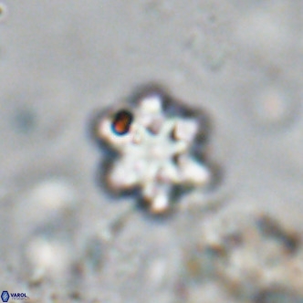 Discoaster catillomicros VR 18663