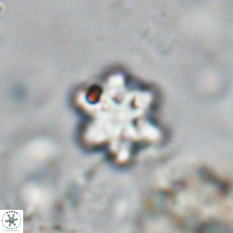 Discoaster catillomicros VR 18663