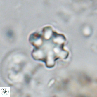 Discoaster catillomicros VR 18664