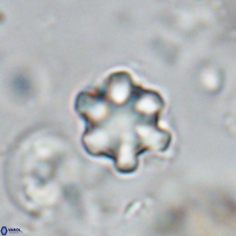 Discoaster catillomicros VR 18665