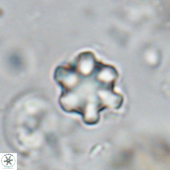 Discoaster catillomicros VR 18665