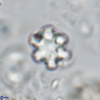 Discoaster catillomicros VR 18667