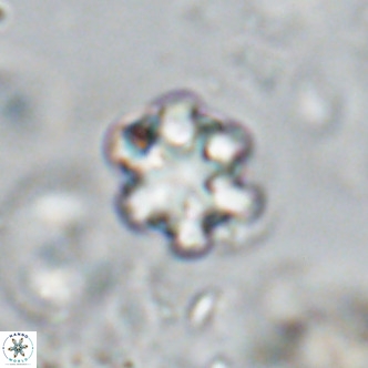 Discoaster catillomicros VR 18667