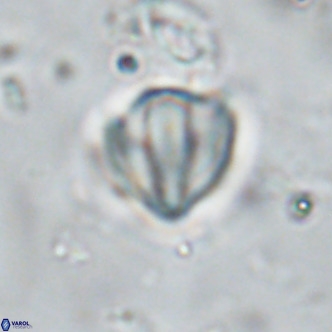 Discoaster catillomicros VR 18668