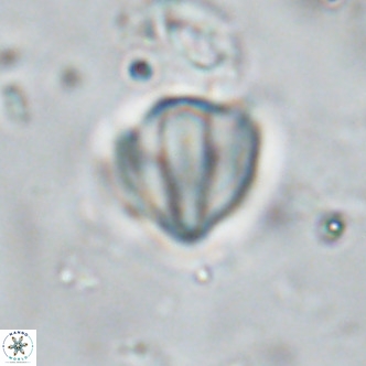 Discoaster catillomicros VR 18668