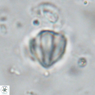 Discoaster catillomicros VR 18669
