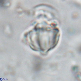 Discoaster catillomicros VR 18670