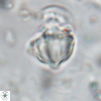 Discoaster catillomicros VR 18670