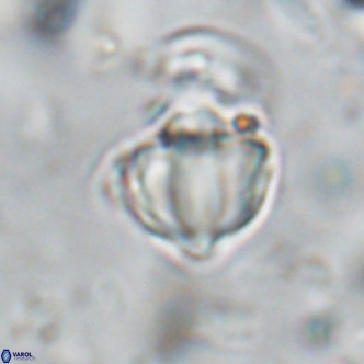 Discoaster catillomicros VR 18671