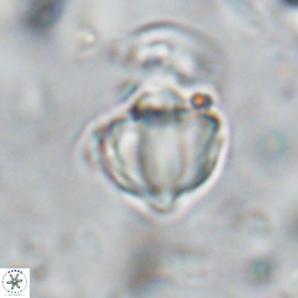 Discoaster catillomicros VR 18671