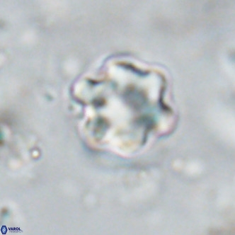 Discoaster catillomicros VR 18672