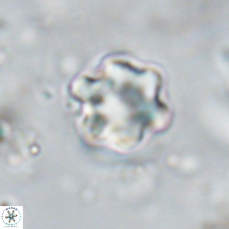 Discoaster catillomicros VR 18672