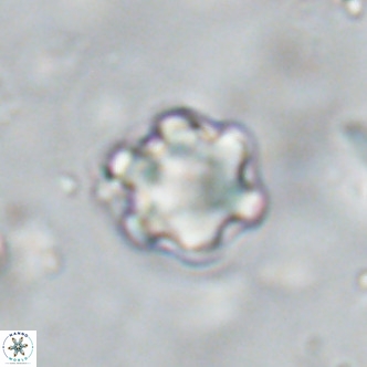 Discoaster catillomicros VR 18674