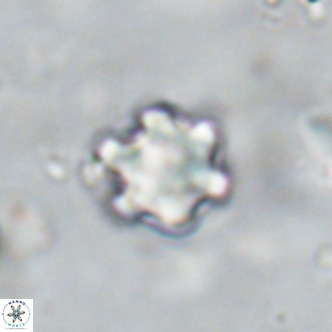 Discoaster catillomicros VR 18675