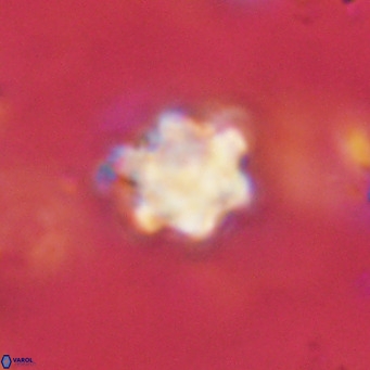 Discoaster catillomicros VR 18676