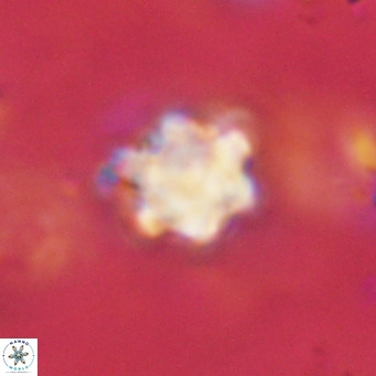 Discoaster catillomicros VR 18676