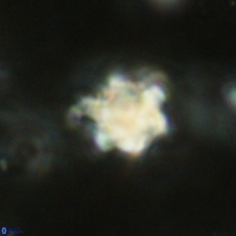 Discoaster catillomicros VR 18677