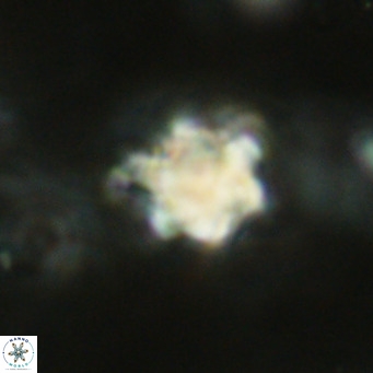 Discoaster catillomicros VR 18677