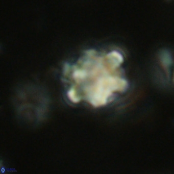 Discoaster catillomicros VR 18679