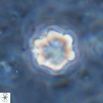 Discoaster catillomicros VR 18683