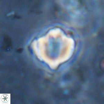 Discoaster catillomicros VR 18684