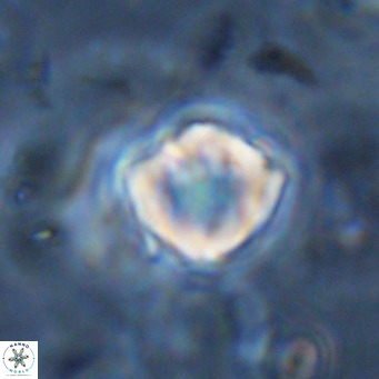 Discoaster catillomicros VR 18685