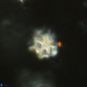 Discoaster catillomicros VR 18691