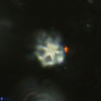 Discoaster catillomicros VR 18692