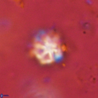 Discoaster catillomicros VR 18693