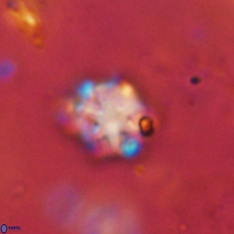 Discoaster catillomicros VR 18694