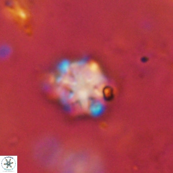 Discoaster catillomicros VR 18694