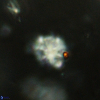 Discoaster catillomicros VR 18695