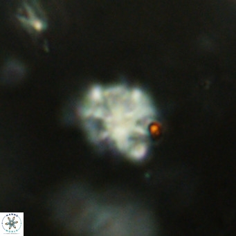 Discoaster catillomicros VR 18695