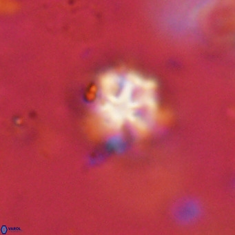 Discoaster catillomicros VR 18698