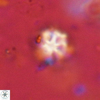 Discoaster catillomicros VR 18698