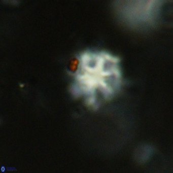 Discoaster catillomicros VR 18699