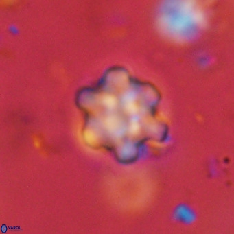 Discoaster catillomicros VR 18700